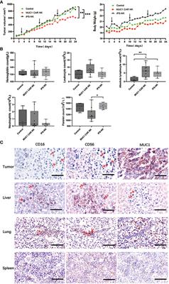 Efficacy of MUC1-targeted CAR-NK cells against human tongue squamous cell carcinoma